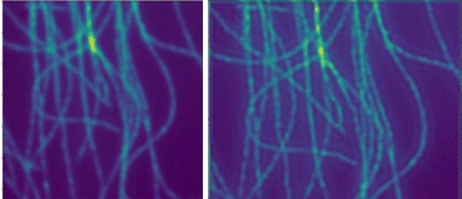 Super-resolution microscopy — Reed et al. (bioRxiv 2025)